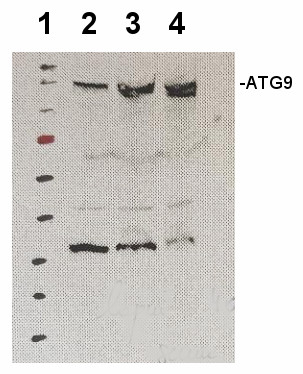 western blot using anti-ATG9 antibodies